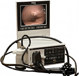 Mobile Video Endoscopy