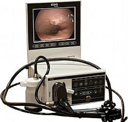 Endoscopy